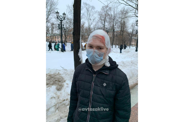 Избитый в Москве на Пушкинской площади / Фото: AvtozakLIVE